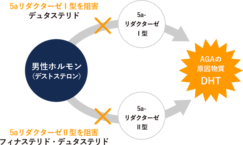 ザガーロカプセル（デュタステリド）が作用するタイプ