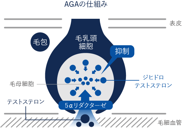 AGAの仕組み