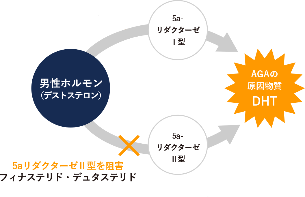 AGAの仕組み