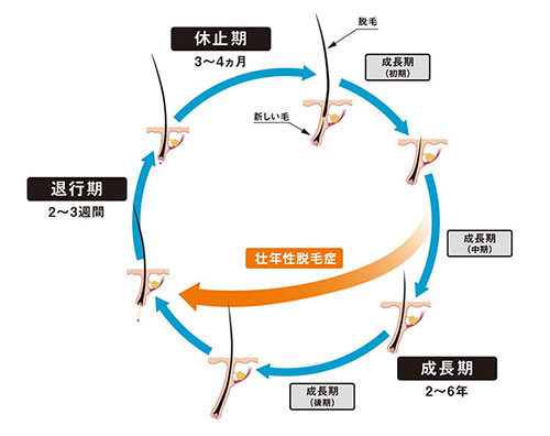 壮年性脱毛症のメカニズム