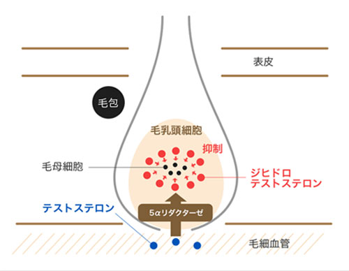 壮年性脱毛症の原因