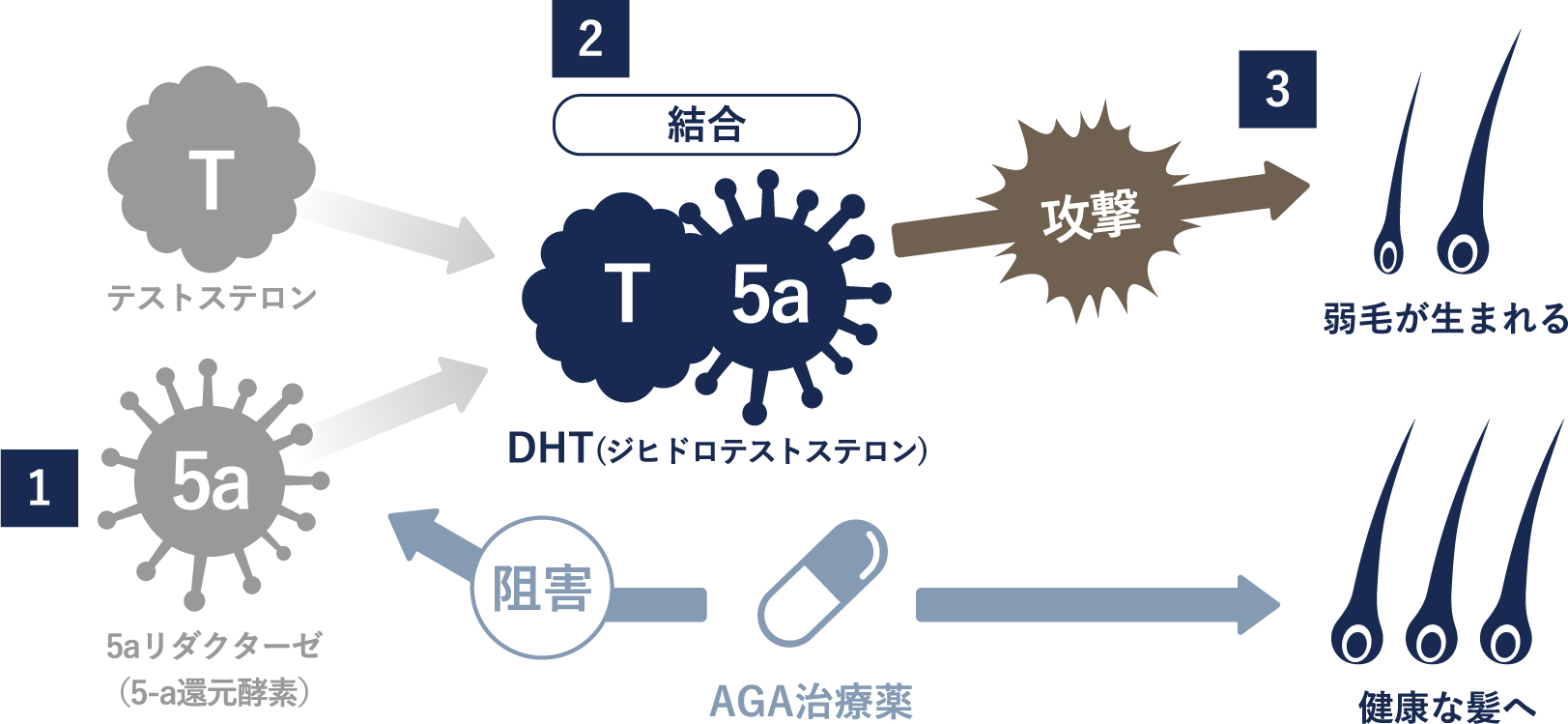 AGAの症状やメカニズム
