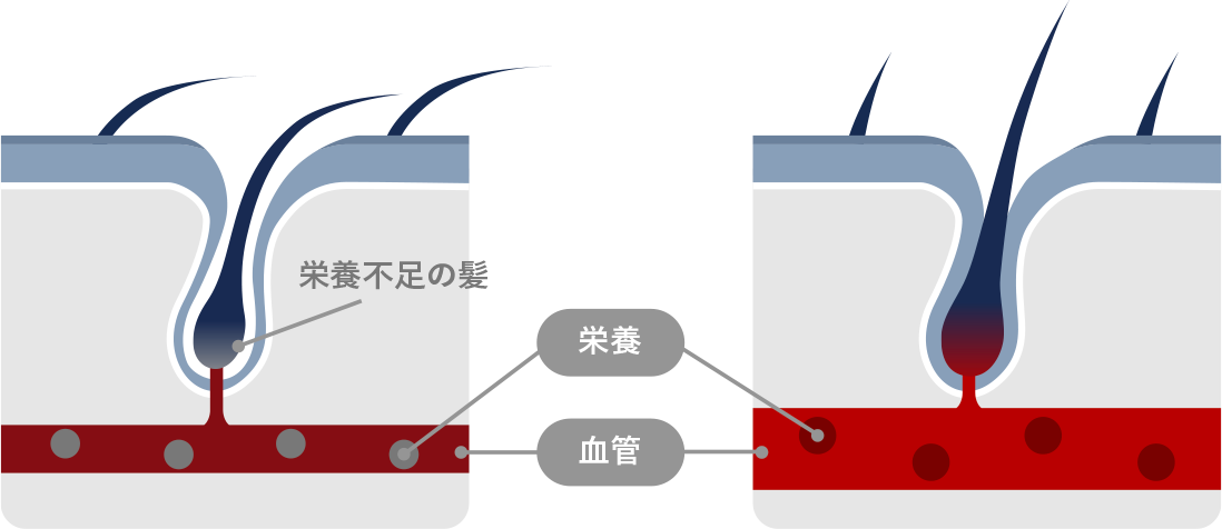 タバコが抜け毛を促進する原因