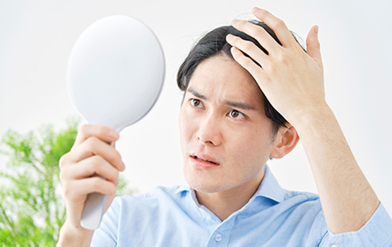 ■ 薄毛症状の原因