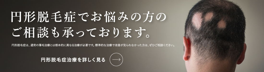 円形脱毛症でお悩みの方のご相談も承っております。円形脱毛症治療を詳しく見る