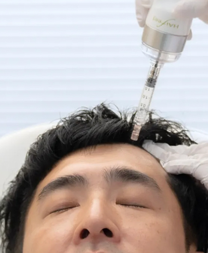 メンズ美容