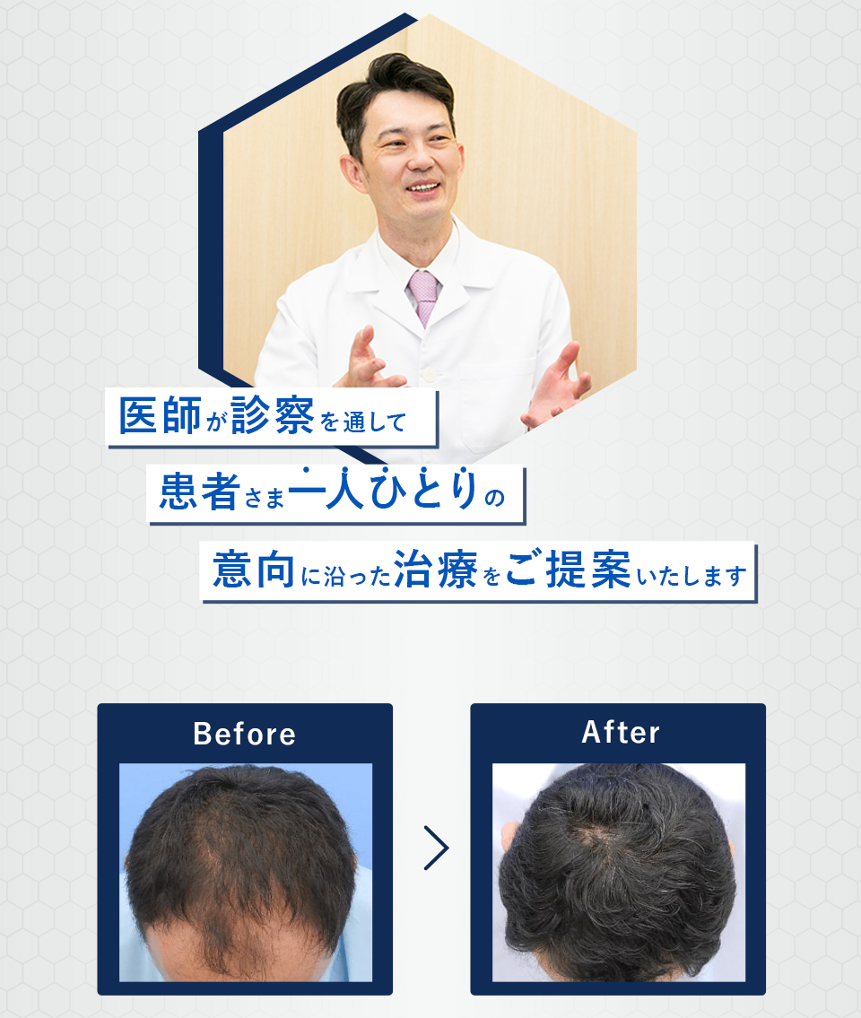 医師が診察を通して患者一人ひとりの意向に沿った沿った治療をご提案いたします