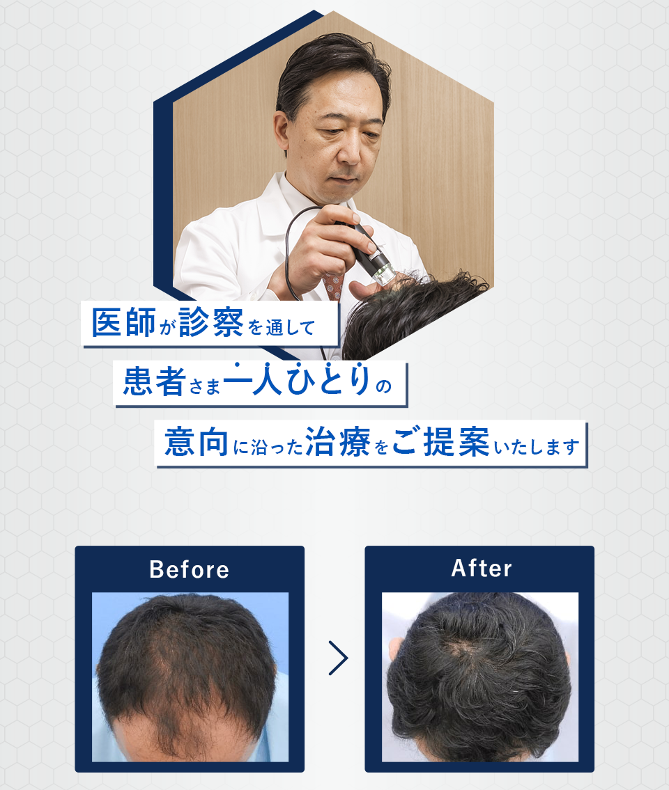 医師が診察を通して患者一人ひとりの意向に沿った沿った治療をご提案いたします
