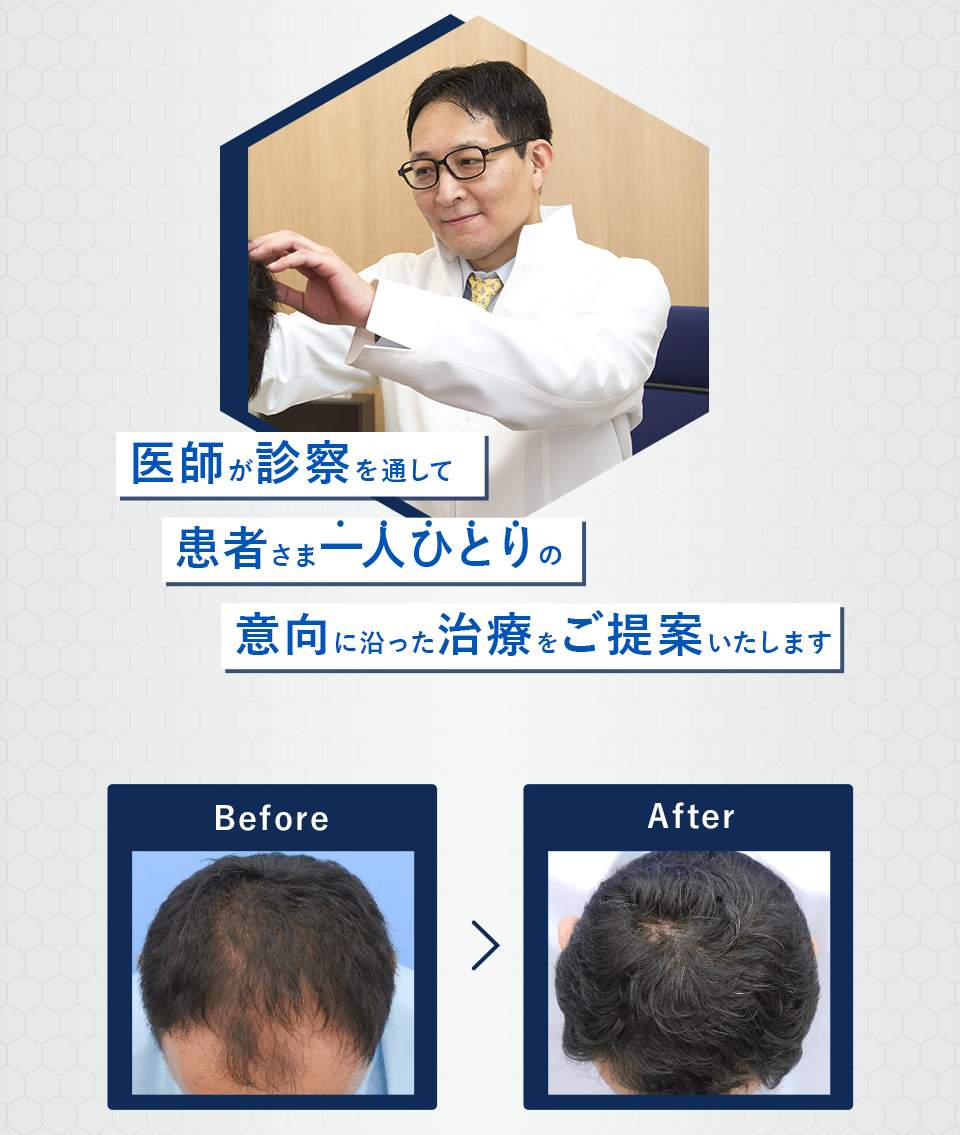 医師が診察を通して患者一人ひとりの意向に沿った沿った治療をご提案いたします