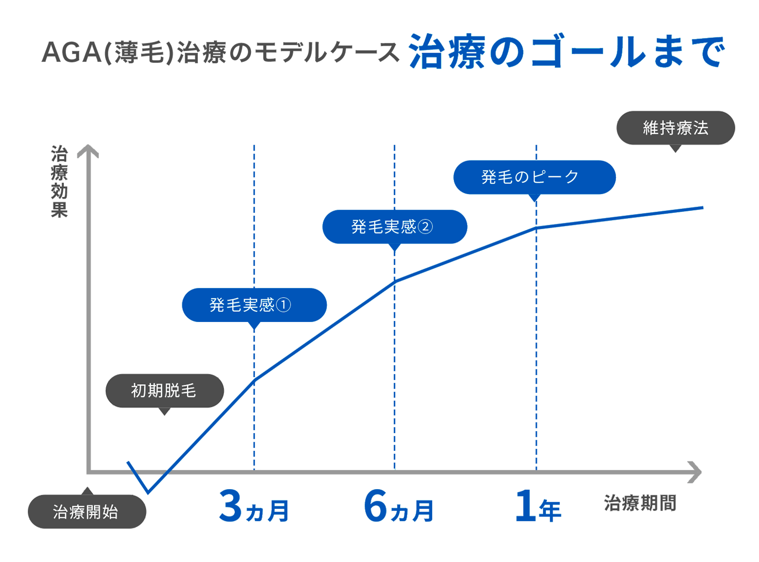 AGA（薄毛）治療のモデルケース 治療のゴールまで