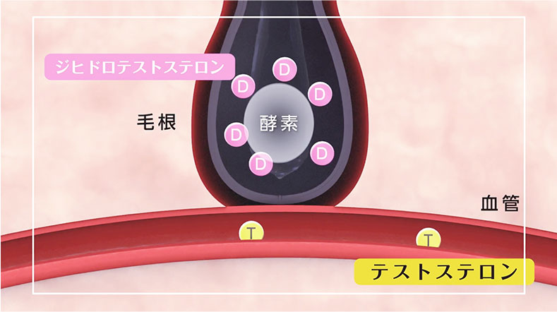 AGA（男性型脱毛症）の仕組み