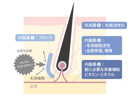 アドバンスト発毛治療