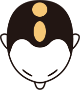 前頭部から頭頂部