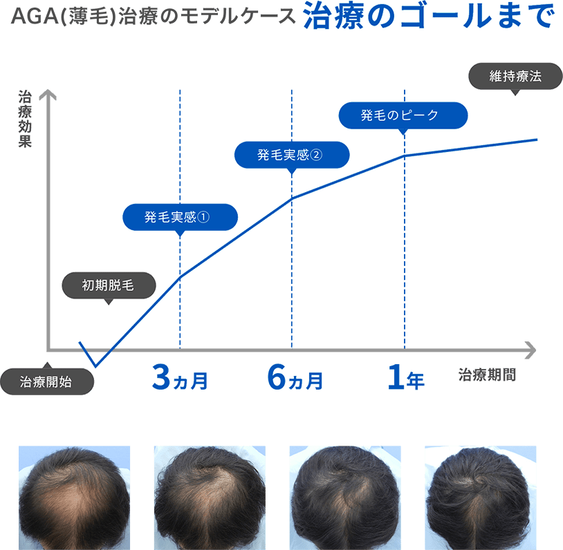 治療スケジュール