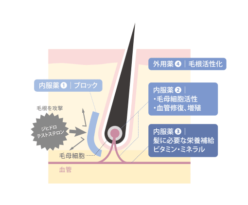 Dクリニックの治療薬の種類