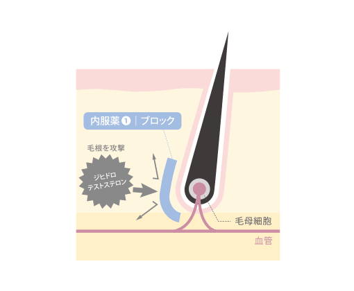 Dクリニックの治療薬の種類