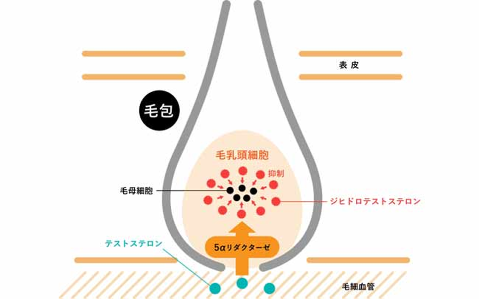女性の薄毛メカニズム