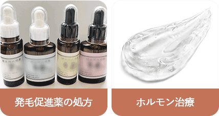 発毛促進薬の処方、ホルモン治療