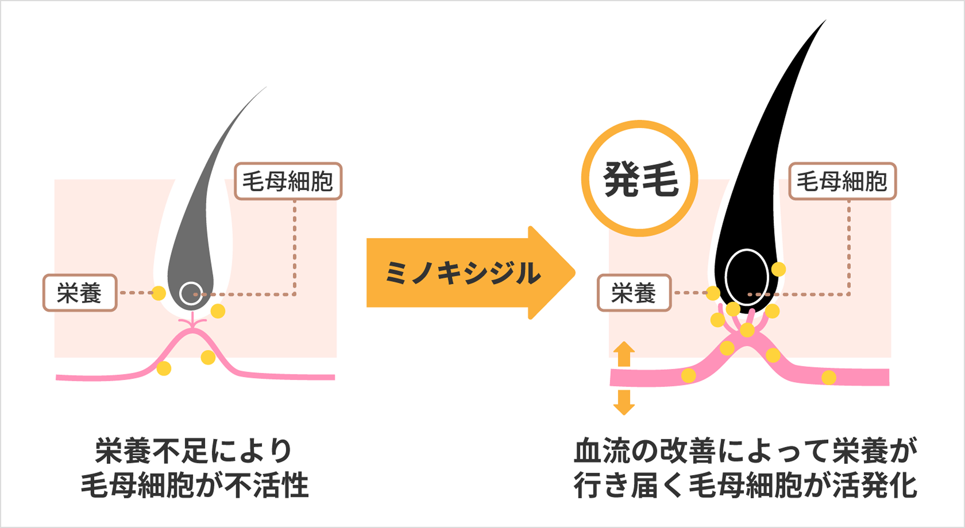 ミノキシジルの作用