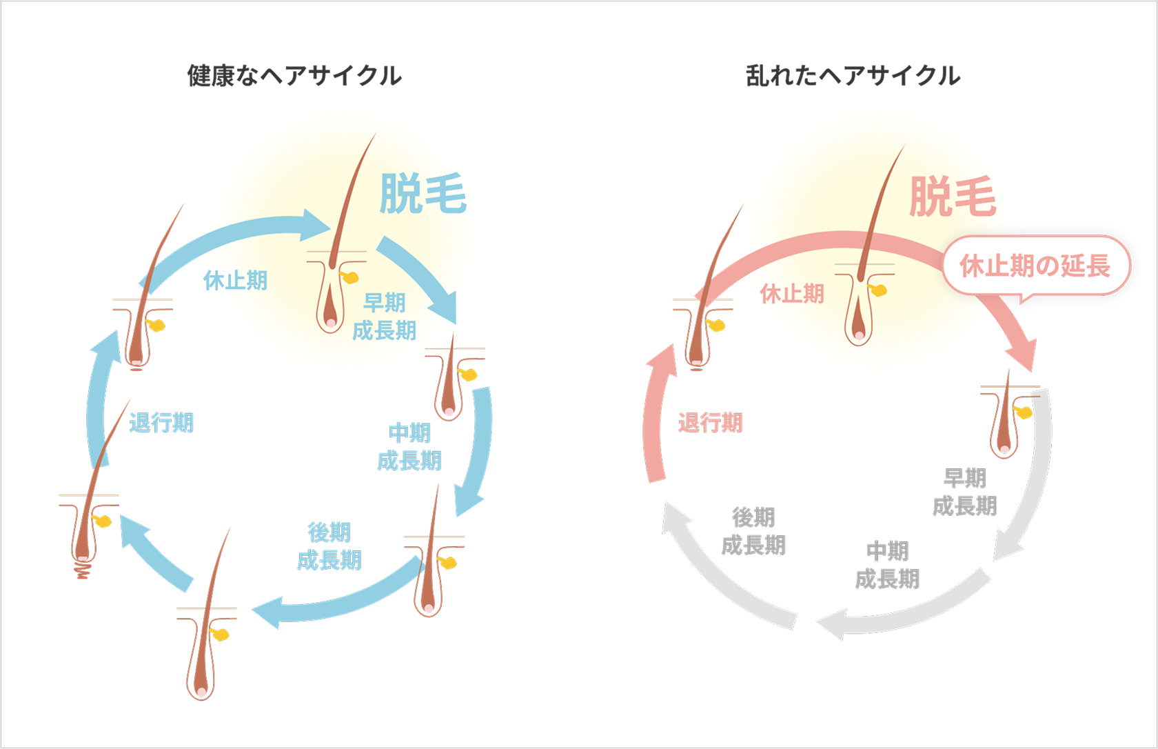 ヘアサイクルでみる女性の薄毛原因